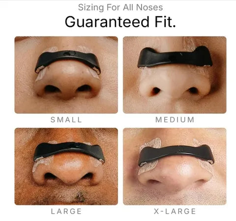 Nasal dilator starter kit