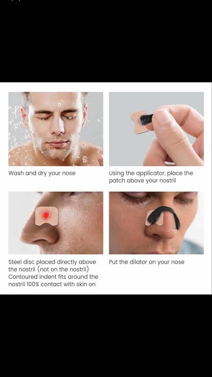 Nasal dilator starter kit